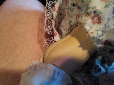 legs attached to body.